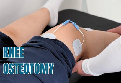 Knee Osteotomy Surgery by Dr Karthik Gudaru